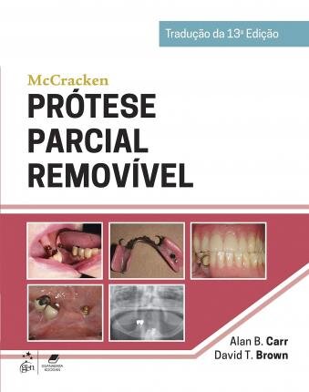 Mccracken Prótese Parcial Removível
