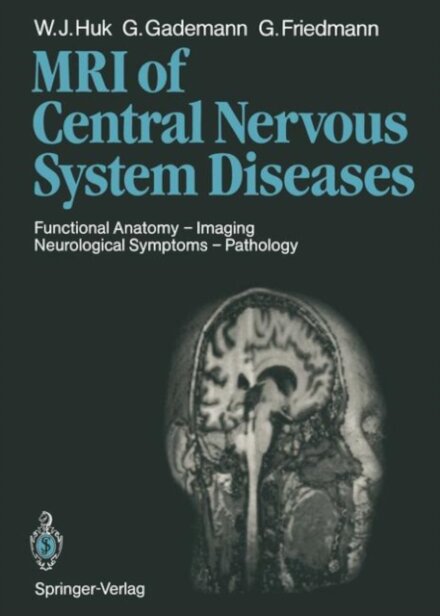 Magnetic Resonance Imaging of Central Nervous System Diseases