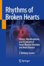 Rhythms of Broken Hearts