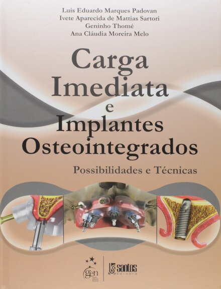 Carga Imediata E Implantes Osteointegrados Técnicas