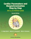 Cardiac Pacemakers and Resynchronization Step by Step