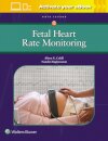 Fetal Heart Rate Monitoring