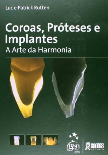 Coroas Próteses E Implantes A Arte Da Harmonia