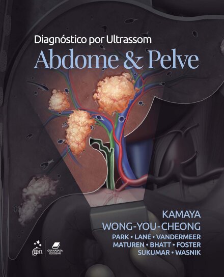 Diagnostico Por Ultrassom Abdome E Pelve
