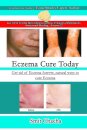 Eczema Cure Today - Get rid of Eczema forever natural ways to cure Eczema