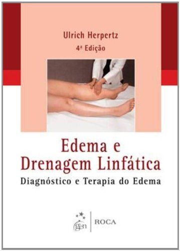 Edema E Drenagem Linfática Diagnóstico E Terapia Edema