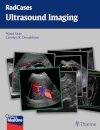 Radcases Ultrsound Imaging