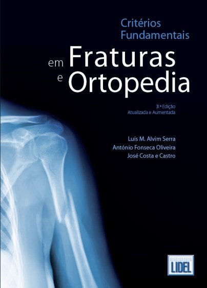 Criterios Fundamentais Em Fraturas