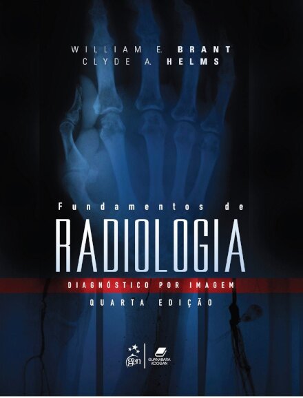 Fundamentos De Radiologia Diagnóstico Por Imagem