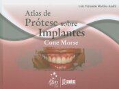 Atlas De Prótese Sobre Implantes Cone Morse