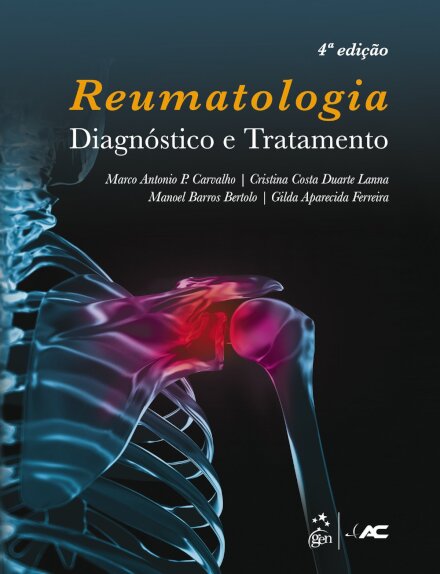 Reumatologia Diagnóstico E Tratamento