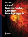 Atlas of Posterior Fundus Changes in Pathologic Myopia