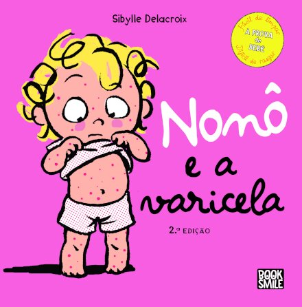 Nonô e a Varicela