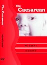 The Caesarean