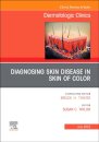 Diagnosing Skin Disease in Skin of Color, An Issue of Dermatologic Clinics