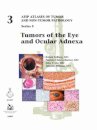 Tumors of the Eye and Ocular Adnexa