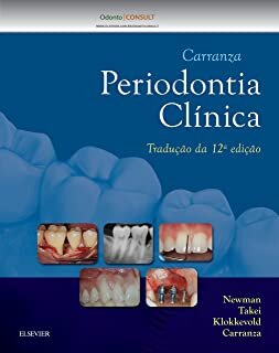 Carranza Periodontia Clínica