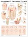 Disorders of the Teeth and Jaw Anatomical Chart