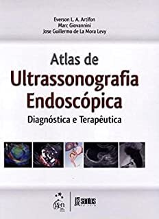 Atlas De Ultrassonografia Endoscópica Diagnóstica E Terapêutica