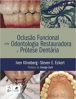 Oclusão Funcional em Odontologia Restauradora e Prótese Dentária