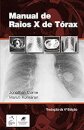 Manual De Raios-X De Tórax