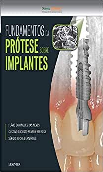 Fundamentos Da Prótese Sobre Implantes