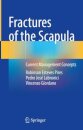 Fractures of the Scapula
