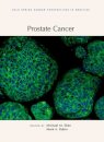 Prostate Cancer