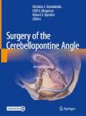 Surgery of the Cerebellopontine Angle