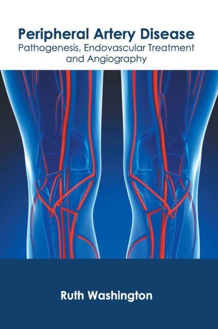 Peripheral Artery Disease: Pathogenesis, Endovascular Treatment and Angiography