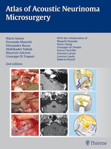 Atlas Acoustic Neurinoma Microsurgery