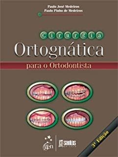 Cirurgia Ortognática Para O Ortodontista
