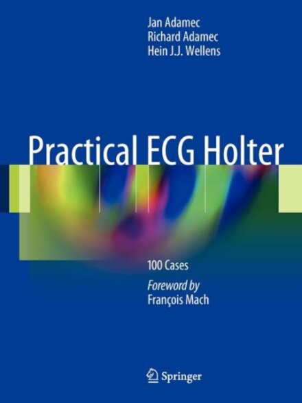 Practical ECG Holter