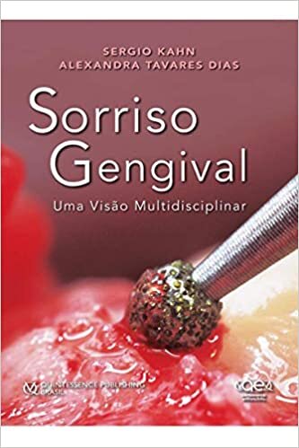 Sorriso Gengival: Uma Visão Multidisciplinar