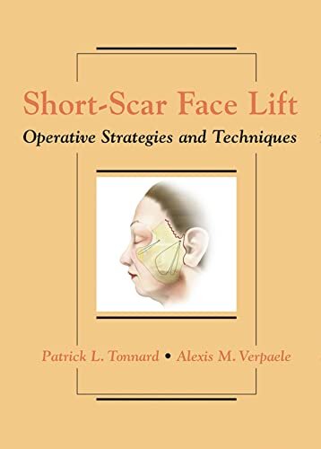 Short-Scar Face Lift