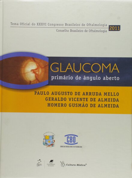Glaucoma Primário De Ângulo Aberto