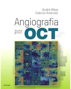 AAngiografia por OCT