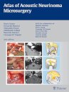 Atlas Acoustic Neurinoma Microsurgery